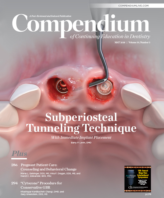 May 2018 | Compendium