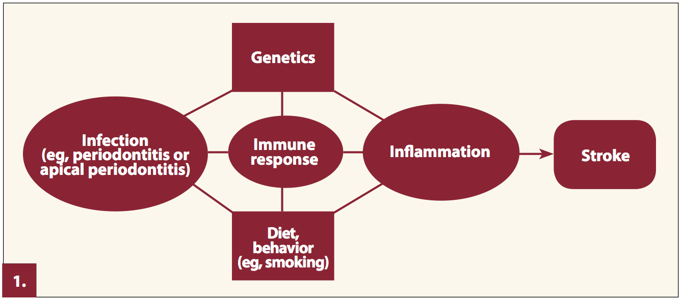 A Role for Oral Health Personnel in Stroke Prevention | Compendium